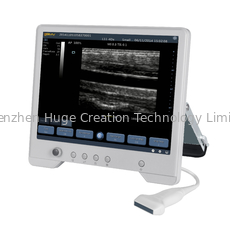 China TS20 digitaal Kenmerkend Ultrasone klanksysteem voor Verloskunde en Gynaecologieafdeling leverancier