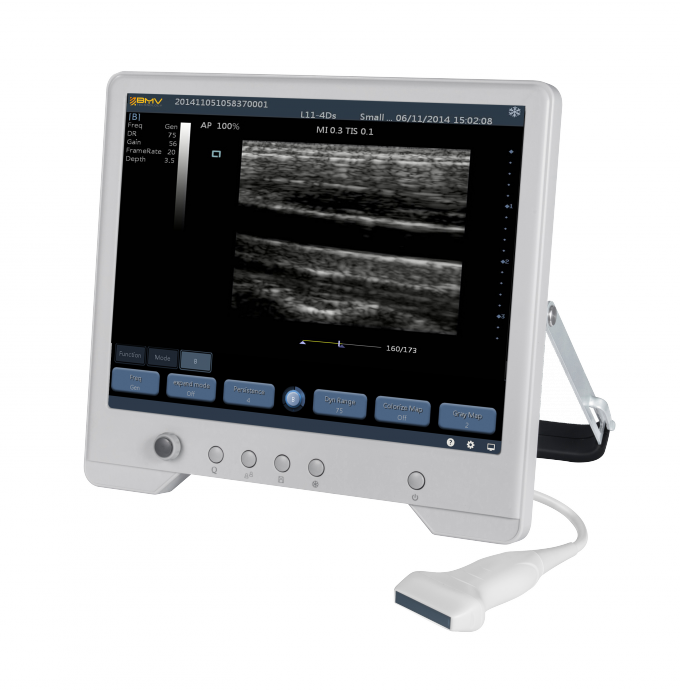 TS20 digitaal Kenmerkend Ultrasone klanksysteem voor Verloskunde en Gynaecologieafdeling