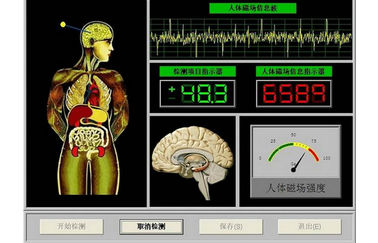 Quantum de Therapiemachine van de Franchversie, Quantumresonantieanalisator leverancier