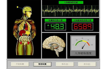 De vrije Analysator van de Download Quantum Subgezondheid voor Schoonheidssalon leverancier