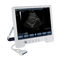 TS20 digitaal Kenmerkend Ultrasone klanksysteem voor Verloskunde en Gynaecologieafdeling leverancier