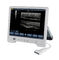 TS20 digitaal Kenmerkend Ultrasone klanksysteem voor Verloskunde en Gynaecologieafdeling leverancier