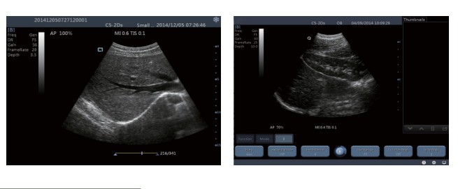 TS20 digitaal Kenmerkend Ultrasone klanksysteem voor Verloskunde en Gynaecologieafdeling